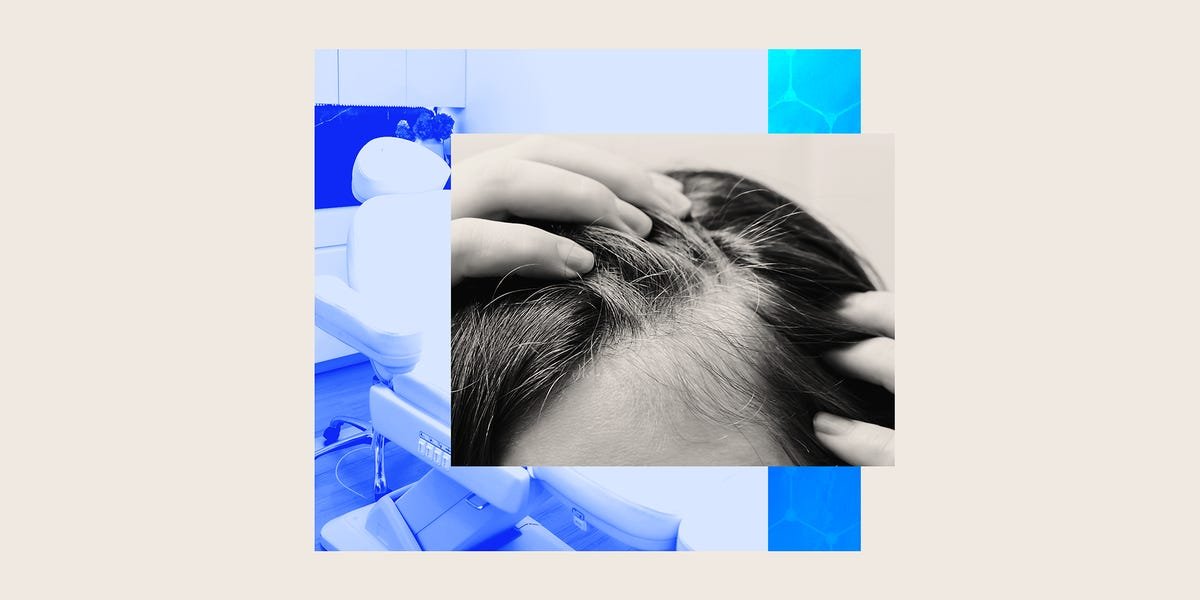 FoLix for Hair Loss: How the Non-Surgical Laser Treatment Works